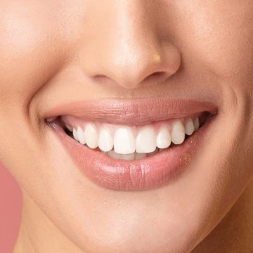 Here’s All You Should Know About Teeth Whitening
